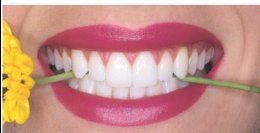 General Dentistry, Teeth Whitening, Smile Makeovers